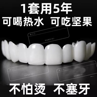 日本品质仿真牙套吃饭神器老人通用假牙套临时牙套缺牙遮丑防塞牙