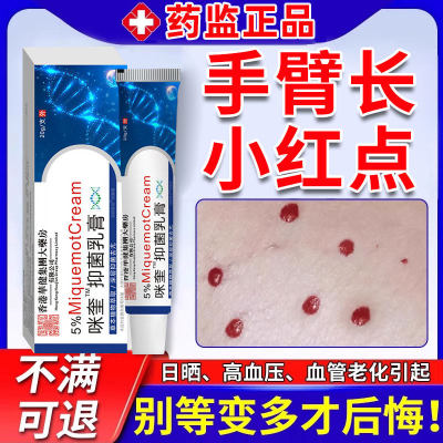 血管瘤血管痣去除可搭软膏去点痣胳膊手臂上小红点红痣樱桃状乳膏