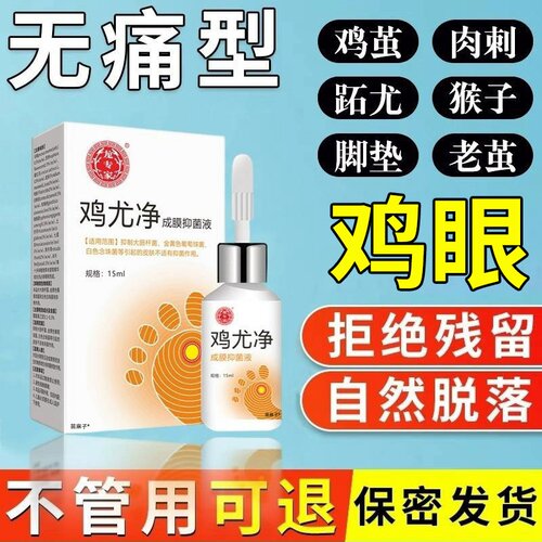 【鸡眼无痛脱落】鸡眼老茧药水