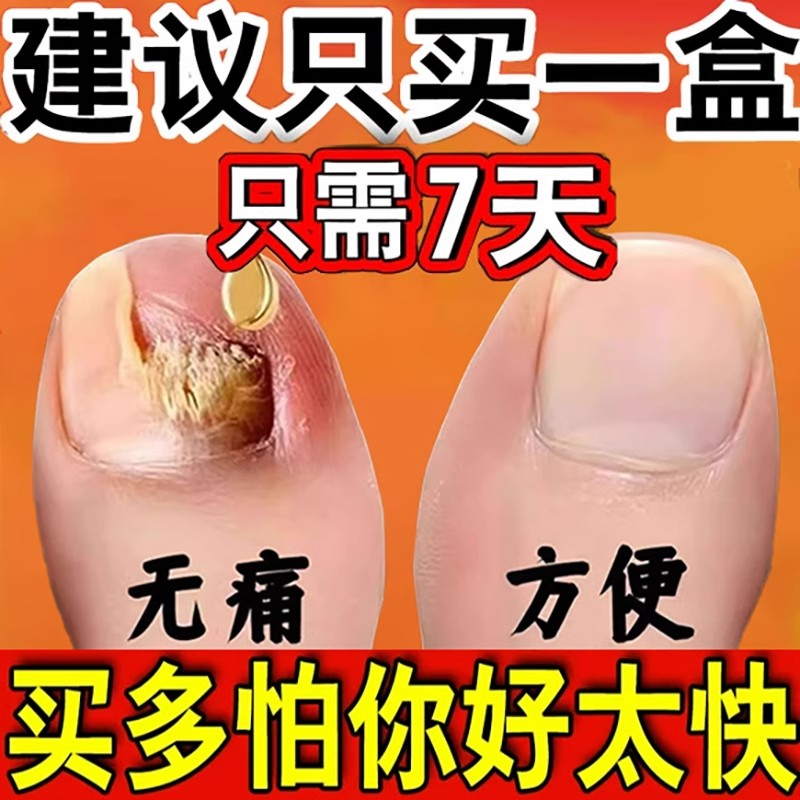 【买五送五】去多年灰甲