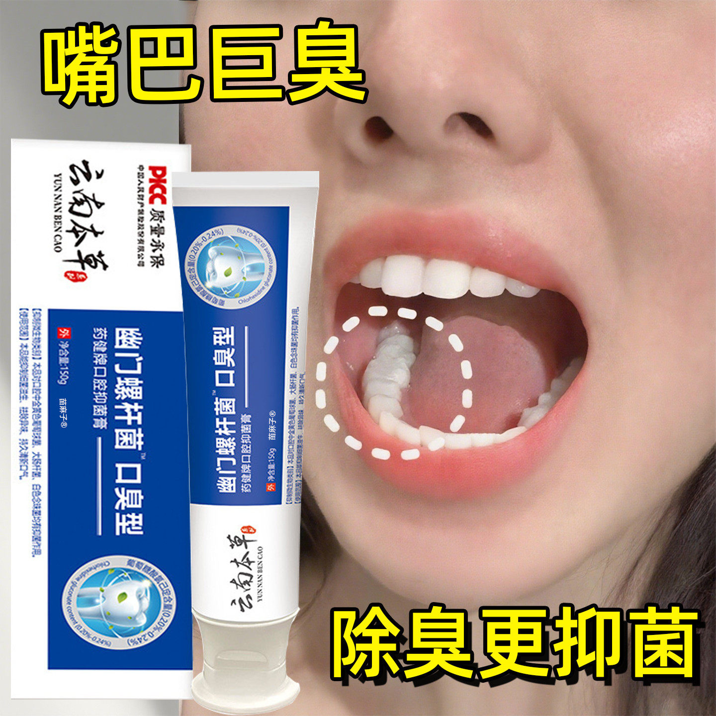 幽螺门旋杆菌医用牙益生菌口腔抑菌膏正品专用去除口臭官方旗舰店