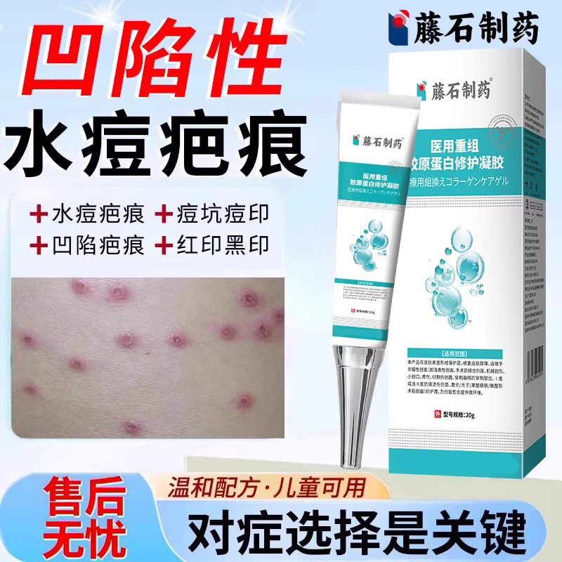 凹陷性水痘疤痕却去水痘坑痘坑痘印生长因子修复凹陷除疤膏儿童VQ