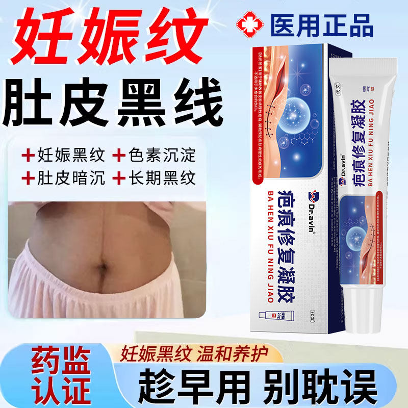 产后肚子黑色素沉淀去黑线祛妊娠纹消除妊辰纹修复霜疤痕除疤膏YZ