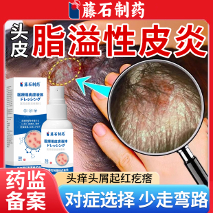 脂溢性皮炎头部喷雾剂头皮屑止痒真菌感染头癣头痒有疙瘩起痤疮WQ