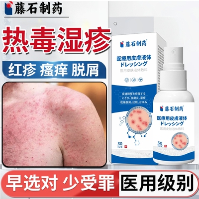 血热热毒湿疹水泡身上长红斑瘙痒喷雾剂止痒去膏根外用顽固皮炎DS