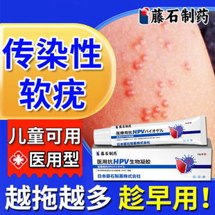 传染性软疣儿童去水猴子夹子祛除搭医用治疗镊子夹用药房同款膏TU