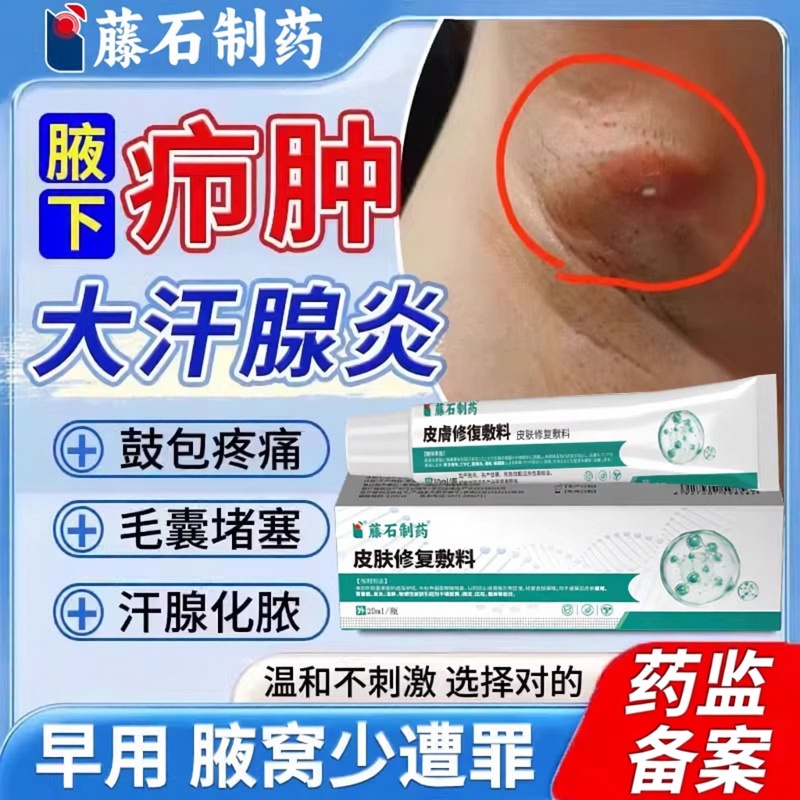 腋下大汗腺炎毛囊炎痘痘硬疙瘩疼痛皮脂腺囊肿拔毒膏药房同款膏TU