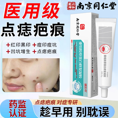 割痣点痣后疤痕护理医用级
