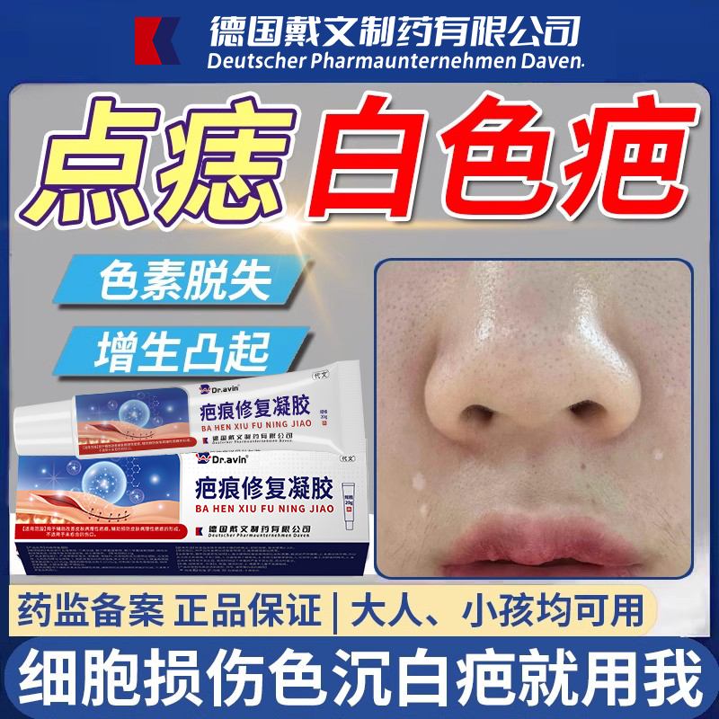点痣白色疤痕色素脱失沉淀淡化去除增生凸起疙瘩修儿童复祛疤膏VQ