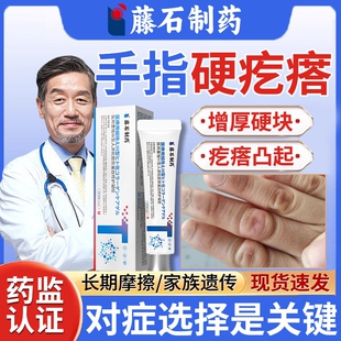 指节垫手指关节茧癣手上长硬疙瘩胼胝老茧去除软化剂药房同款膏YZ