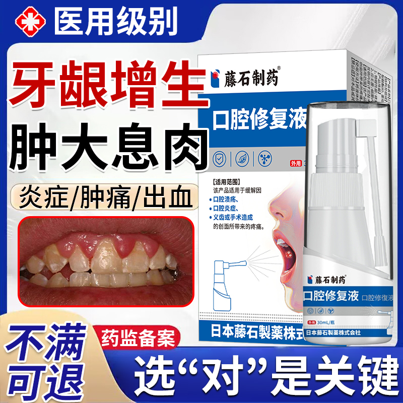牙龈增生红肿痛消炎出血喷雾