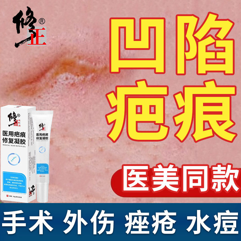 修正医用凹陷性疤痕修复脸上生长因子遮瑕水痘坑硅胶填充除疤膏wq