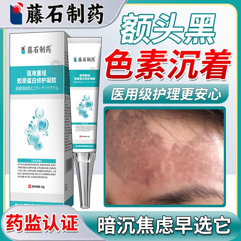 额头黑色素沉淀沉着去除淡化脸部脸上黑斑祛痘印疤印药房同售膏HT