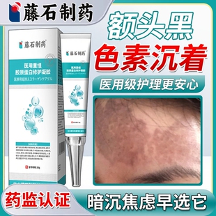 额头黑色素沉淀沉着去除淡化脸部脸上黑斑祛痘印疤印药房同售膏HT