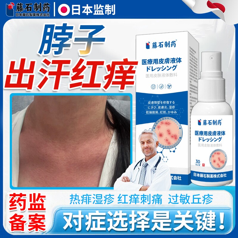 夏天脖子出汗红痒皮肤过敏热毒湿疹搭去成人痱子粉根防淹止痒膏VQ