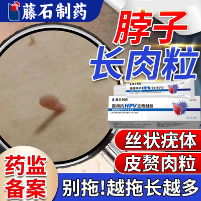 藤石制药--脖子长肉粒丝状疣