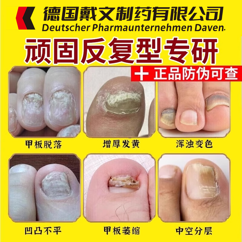 T0P.O1三天型无痛祛灰甲专用