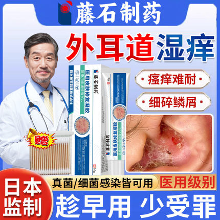 外耳道炎湿疹耳朵痒真菌感染止痒去领专用和根真菌性药房同售膏CB