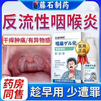 反流性咽喉炎肿痛有异物感