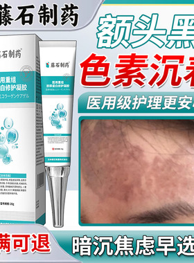 额头黑色素沉淀沉着去除淡化脸部脸上黑斑祛痘印疤印药房同售膏HT