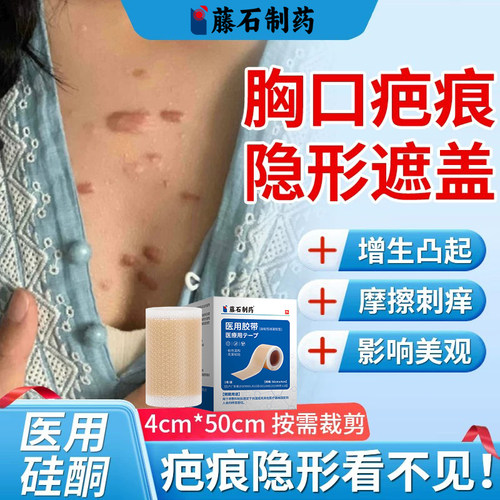 胸口疤痕隐形贴医用硅酮亲肤透气