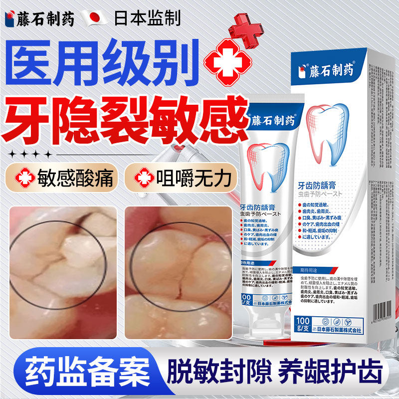 牙隐裂修复医用型牙膏牙齿裂纹修复液抗敏感牙釉质修护咬合疼痛YZ,医疗器械,牙齿防龋/脱敏类,淘宝优惠券,粉丝福利购,淘宝优惠卷