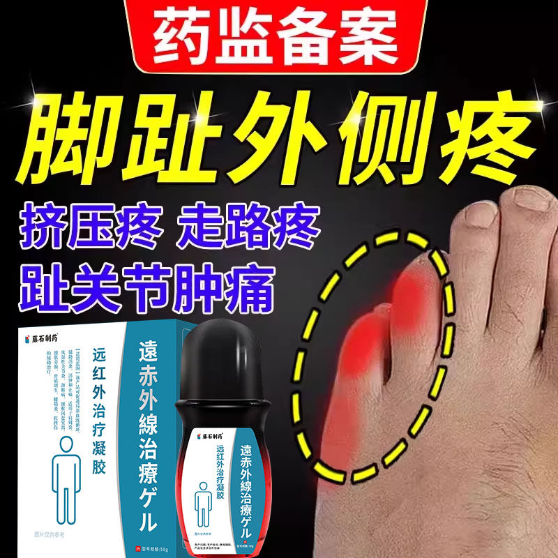 小脚趾疼痛外侧挤压磨出茧子小拇指脚指头关节肿痛搭膏TU