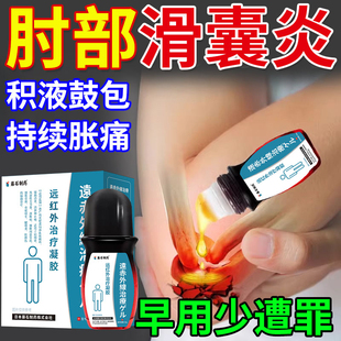 尺骨鹰嘴滑囊炎胳膊肘关节积液疼痛手臂肿热敷专用贴膏药房有售YZ