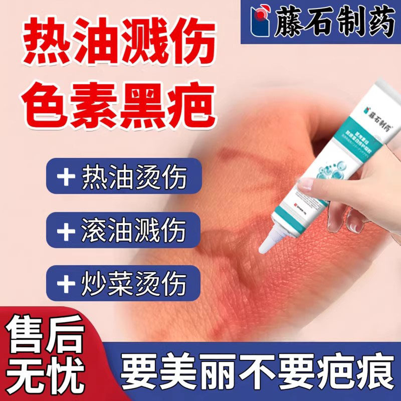 被油油烫伤去疤膏疤痕修皮肤凝胶复祛黑印除黑色素沉淀祛疤膏VQ
