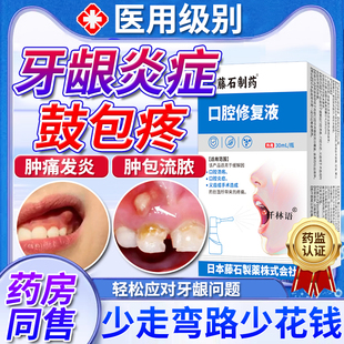 牙龈脓包肿痛牙根发出血喷雾剂牙龈牙周炎药房同款可搭漱口水用HT