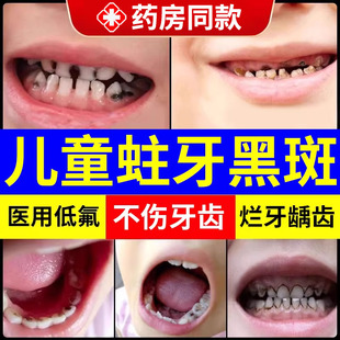 儿童牙膏防蛀牙龋齿专用牙虫牙齿黑线去除缝隙黑牙菌斑药房有售DS