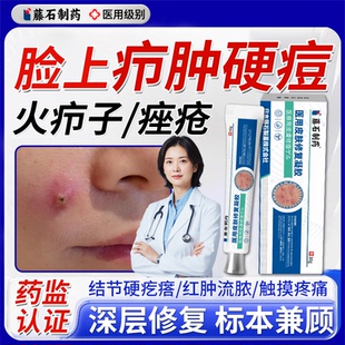 脸上疖肿结节硬块痘痘起硬疙瘩红肿毛囊炎痤疮火疖子囊肿脓包型WQ