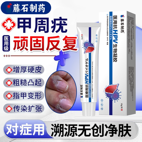速发】甲周疣医用抗hpv生物凝胶