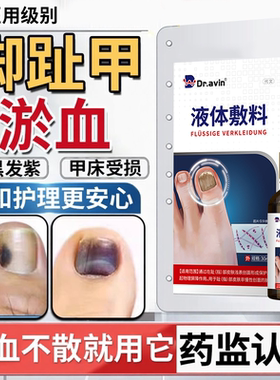 脚趾甲被砸指甲被夹压受损瘀血发黑甲床受伤甲下淤血发紫生长液HT