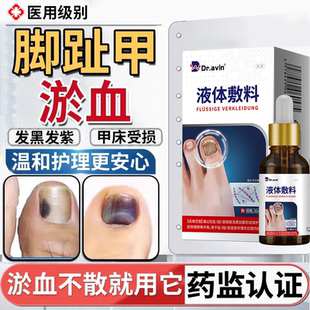 脚趾甲被砸指甲被夹压受损瘀血发黑甲床受伤甲下淤血发紫生长液HT