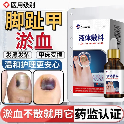 【液体敷料】指甲趾甲被砸淤血