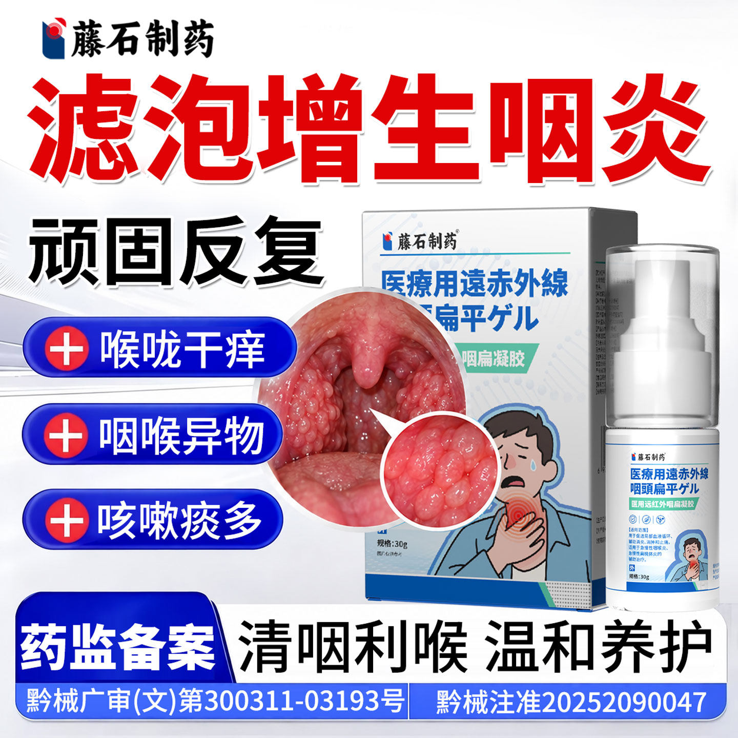 咽喉淋巴滤泡增生慢性咽炎咽喉炎除根异物感专用喷雾剂药房同款YZ