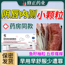 女性假性尖锐湿疣止痒膏凝胶专用外阴有小疙瘩阴道口去除私处WQ