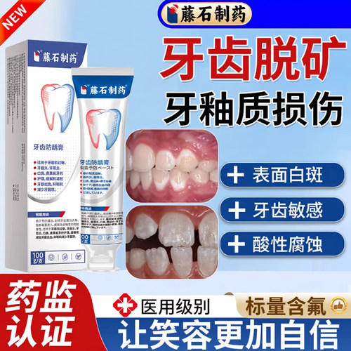牙齿脱矿含氟不辣口-药监认证