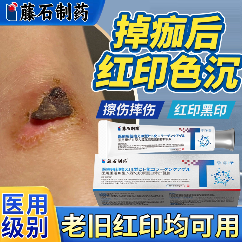 掉痂后红印修复Ⅲ型胶原蛋白凝胶图片