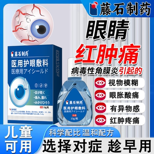 病毒性角膜炎儿童结膜充血畏光流泪可搭眼部疼痛滴眼液眼药水用VQ