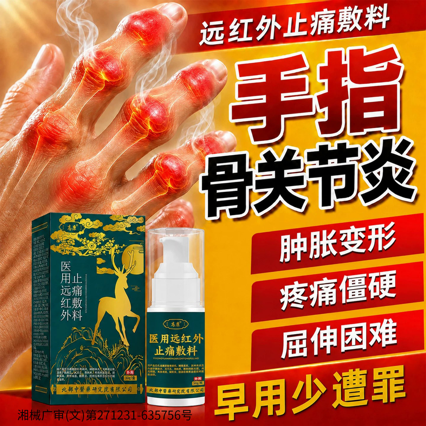 手指关节粗大变形僵硬疼痛专用图片