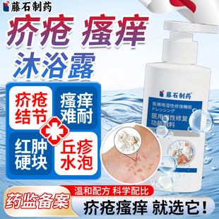疥疮疥螨疥虫阴囊结节硫磺除螨沐浴露皮肤瘙痒软膏泡澡药房同售VQ
