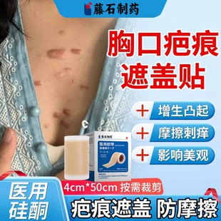 胸口疤痕增生凸起去除疙瘩隐形贴压力加压瘢痕修复凹凸遮盖神器WQ