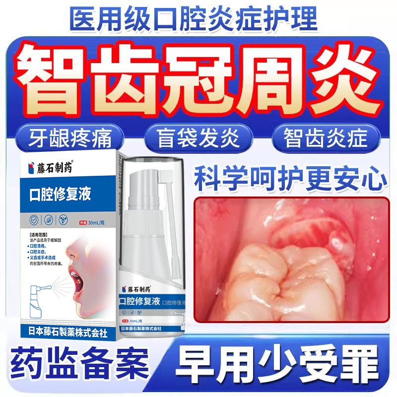 【口腔科同款】智齿冠周发炎疼痛