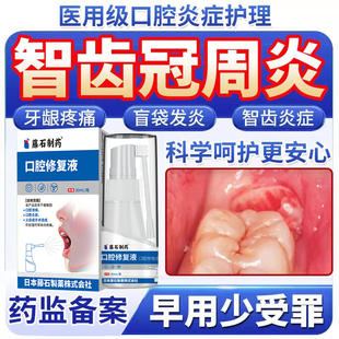智齿冠周炎牙龈肿痛脓包药房同售牙膏漱口水用牙疼牙痛喷雾喷剂TU