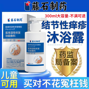 结节性痒疹专用皮肤顽固瘙痒可搭红硬疙瘩止痒沐浴露药房同售用WQ