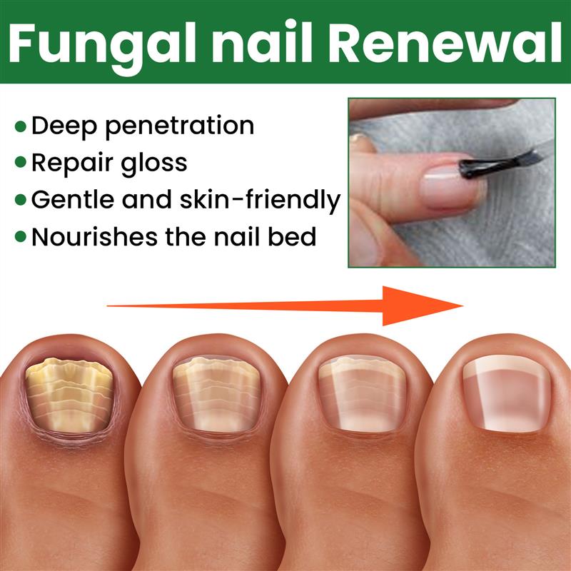 Nail conservation nutrients, warm and rinsed hands and foot