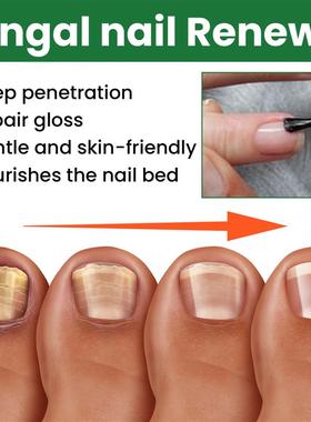 Nail conservation nutrients, warm and rinsed hands and foot