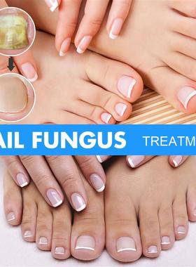 Nail and nails, hand and ash nails, ash and nail fluids, thi